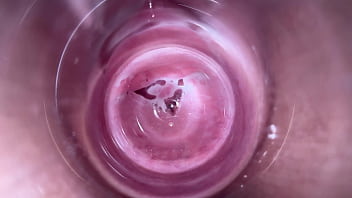 camera inside vagina during