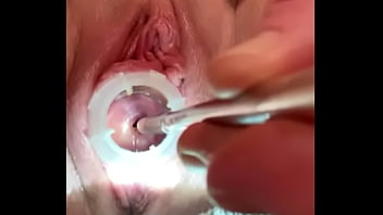 cervix masturbation