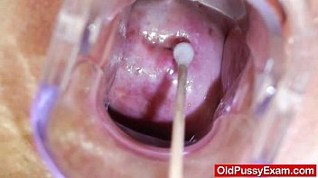 vaginal prolapse porn