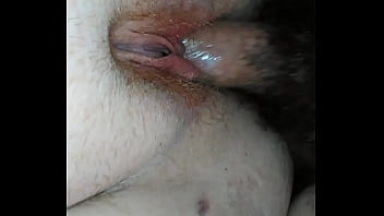 hairy painful anal