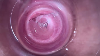 camera inside vagina during